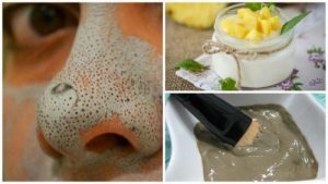 5 utrolige masker til hudorme fri hud