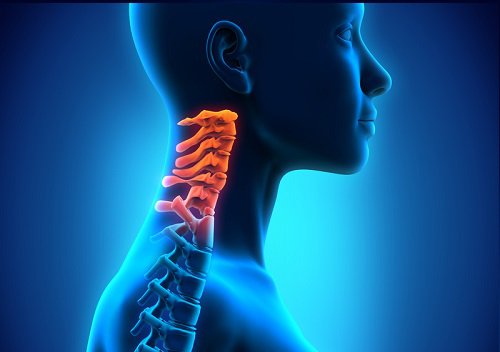 cervikal spondylose