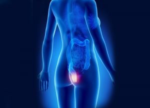 9 naturlige midler mod hæmorider