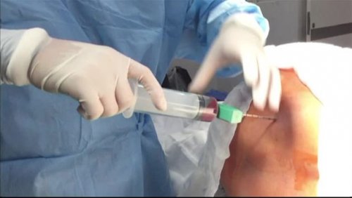 Du kan nemt donere knoglemarv