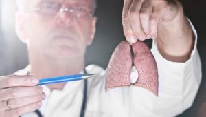 Nyt håb for lungekræftpatienter