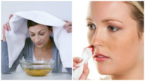 7 effektive hjemmelavede løsninger mod næseblod