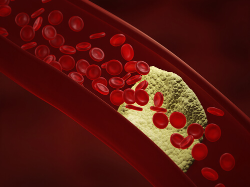 Blodkar blodceller og fremmed vaekst