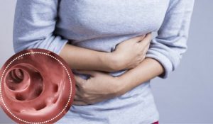 Sådan kan du bekæmpe diverticulitis naturligt