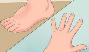 5 nemme måder at mindske væskeophobning på