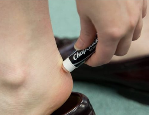 Person smoerer laebepomade paa sin vabel