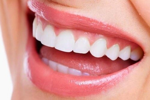 Et hvidt smil