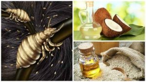 Naturlig behandling af lus: De fem bedste lusemidler