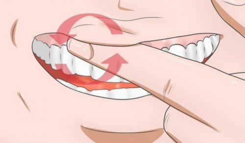14 årsager til blødende tandkød