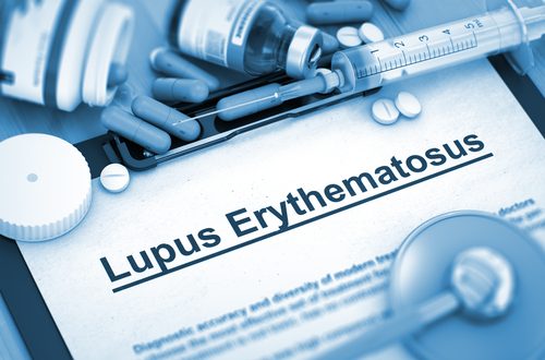 Hvad er lupus sygdom?