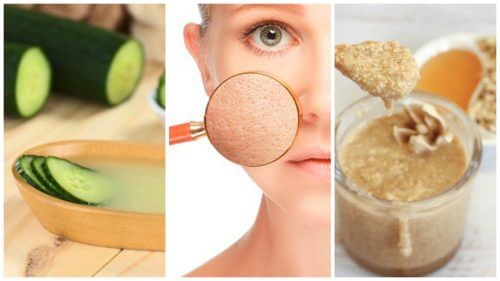 Væk med store porer – fem naturmidler, der kan hjælpe