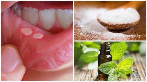 Syv hjemmebehandlinger mod sår i munden