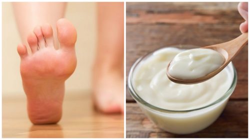 Hjemmelavet behandling af yoghurt og eddike mod hård hud på fødderne
