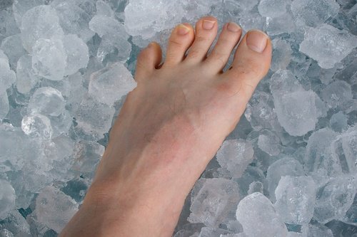 Person der har sin fod i is