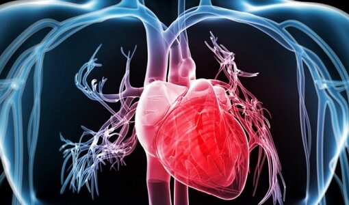 Hjertestopsymptomer du kun finder hos kvinder