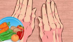 5 simple typer morgenmad til gigt: gør dem til en del af din kost!