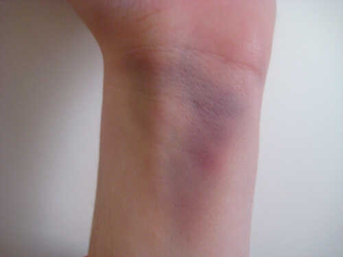 Blaat maerke paa haandled - Bruge bananskrael