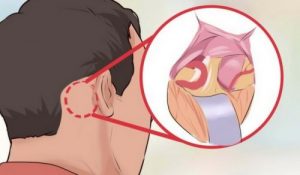 5 ting, du bør vide om trigeminusneuralgi, den værste smerte, der findes