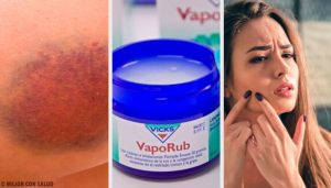 11 overraskende ting du kan bruge Vicks VapoRub til