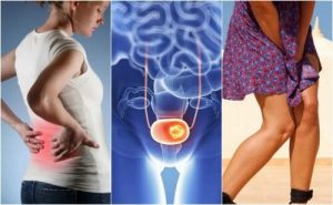 7 tegn på blærekræft du skal holde øje med