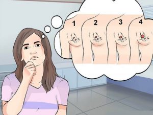 De forskellige former for brystkræft, symptomer og behandling