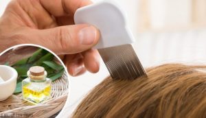 6 hjemmemidler til at fjerne lus