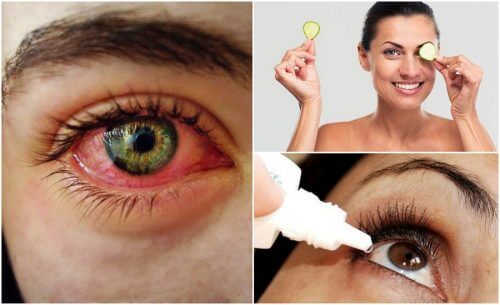 Tørre øjne syndrom: Hvordan du bekæmper det naturligt