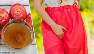 Midler mod vaginal kløe og brændende fornemmelser