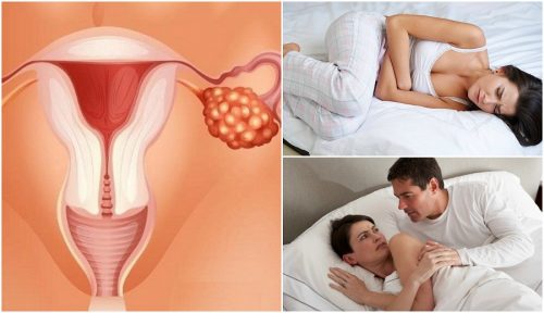 7 æggestokkræft symptomer alle kvinder bør kende til
