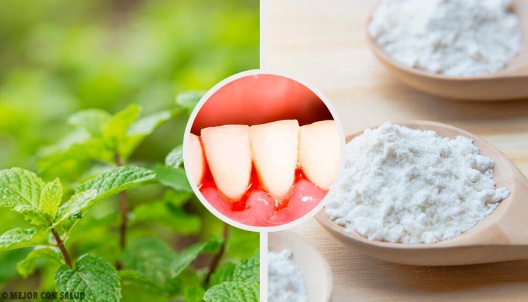 5 effektive hjemmemidler mod tandkødsbetændelse