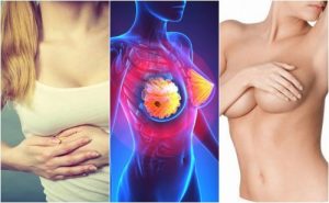 9 symptomer på brystkræft alle kvinder skal vide