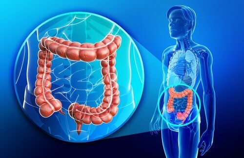 Hvad er Crohns sygdom