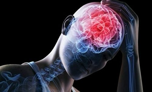 Cerebral emboli