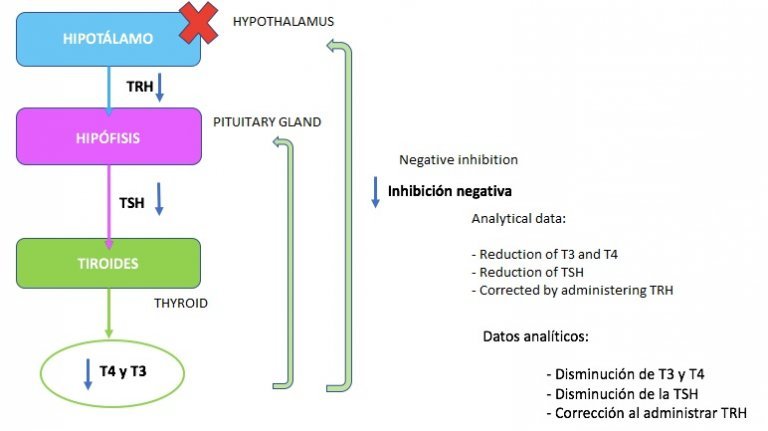 Skema - hvad er Hypothyroidisme
