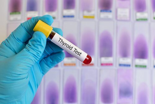 Blodproeve - hvad er Hypothyroidisme