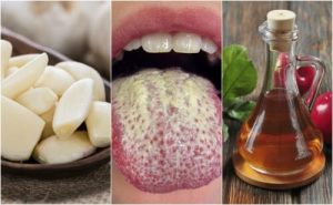 Kontroller candida med seks naturlige midler