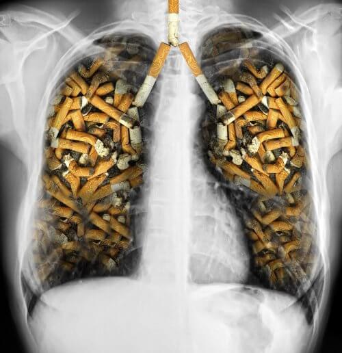 Rygerlunger - myter om rygning