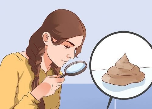 Det siger farven på din afføring om din sundhed