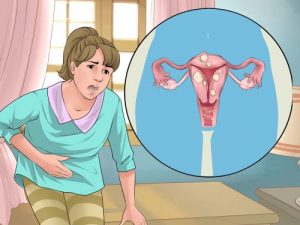De fire mest almindelige menstruationsproblemer