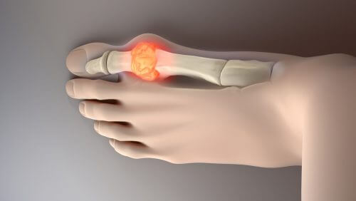 Otte eksempler på mad, der kan sænke urinsyre