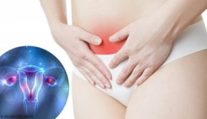 Endometriose symptomer og løsninger du skal kende