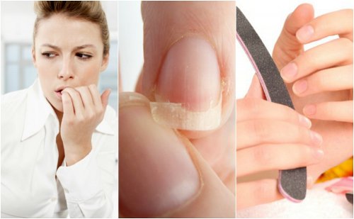 8 grunde til at dine negle er skrøbelige