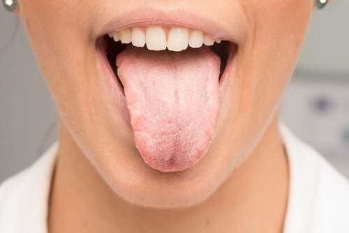 Kvinde med hvid tunge