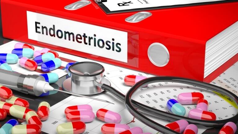 Endometriose