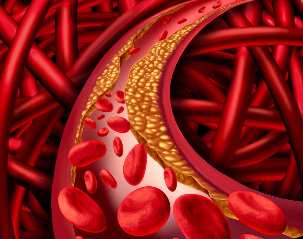 Kolesterol i blodbanen