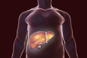 De bedste naturlige midler til at hjælpe med at afgifte din lever