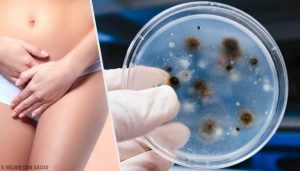 Vaginale infektioner: Typer og årsager