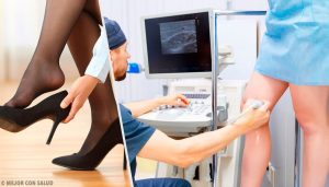 Fjern åreknuder med disse 3 naturlige midler