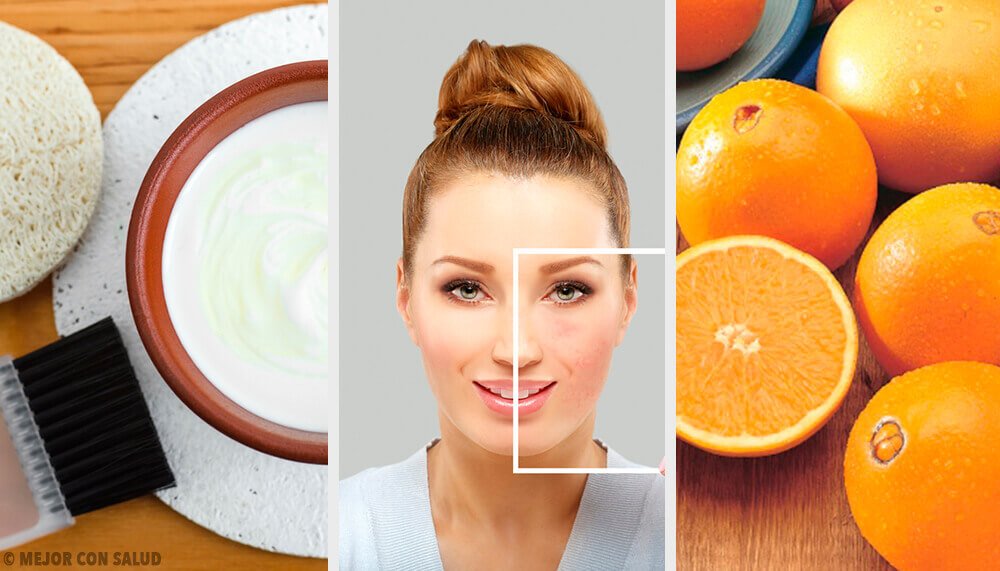 Utrolige naturlige måder til at slippe af med hudpletter