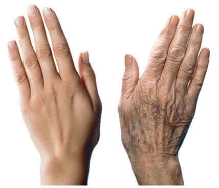 7 anbefalinger til at pleje aldrende hænder